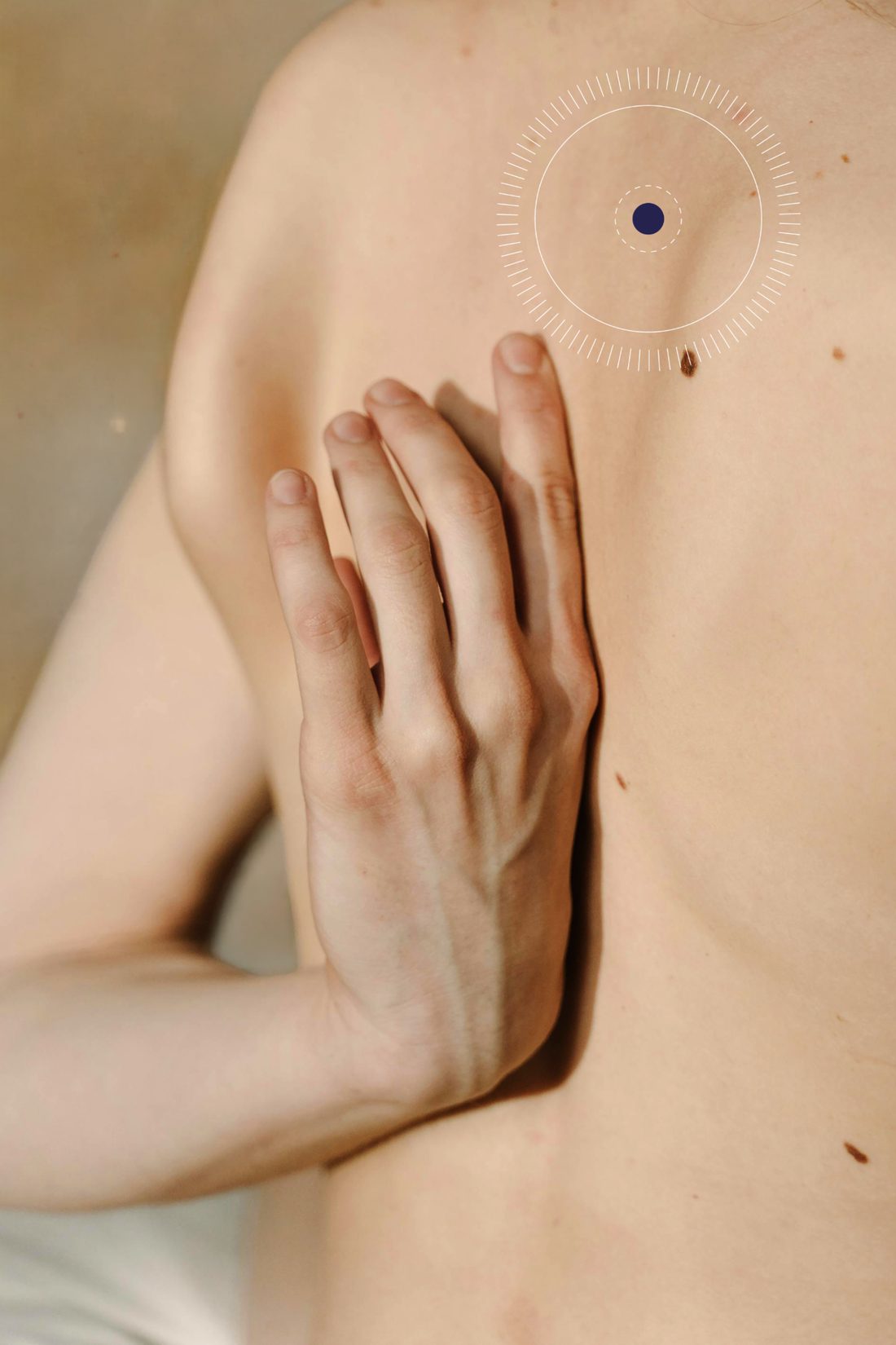 A hand on a bare back, with a highlight marker around a mole on the shoulder