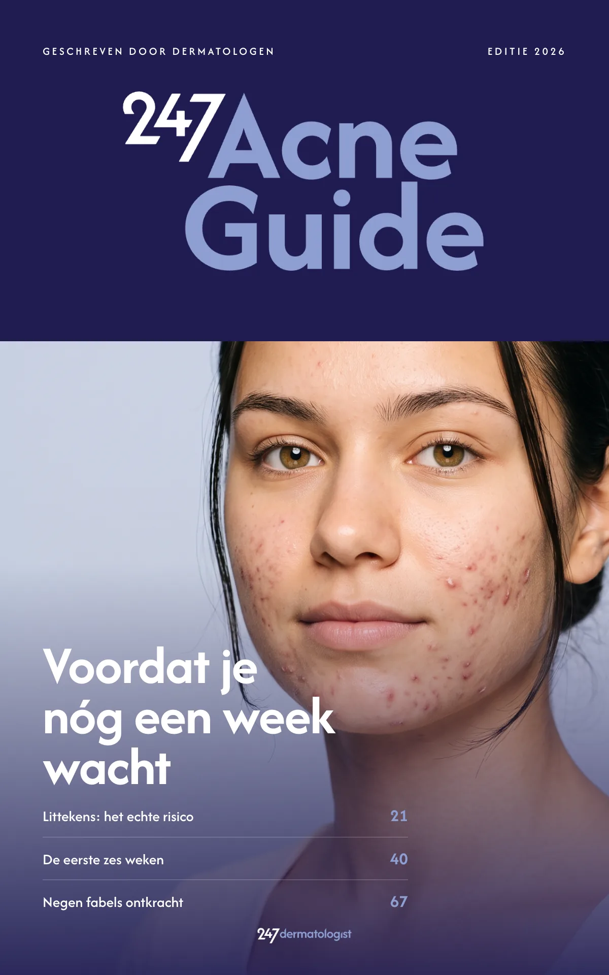 Cover van De Acne Gids, editie 2026